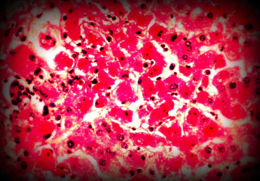  arte digitale fotografia picasa batterio virus 