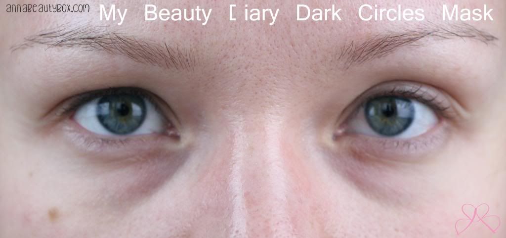 My Beauty Diary Dark Circles Mask